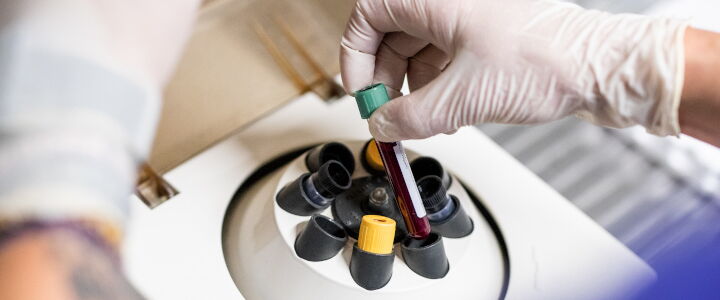 Herstellung von plättchenreichem Plasma in einer Zentrifuge