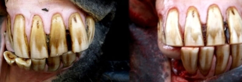 Zahnextraktion vorher/nachher