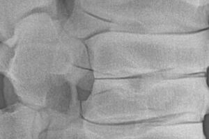 Röntgenaufnahme einer Pferdewirbelsäule