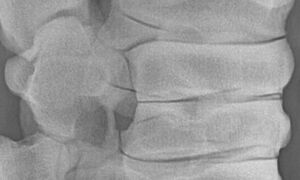 Röntgenaufnahme einer Pferdewirbelsäule