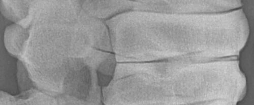 Röntgenaufnahme einer Pferdewirbelsäule