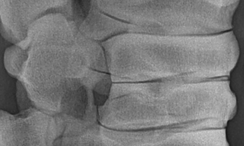Röntgenaufnahme einer Pferdewirbelsäule